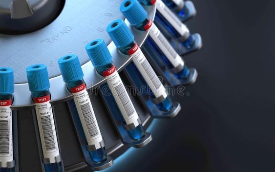 How to maintain the centrifuge daily?