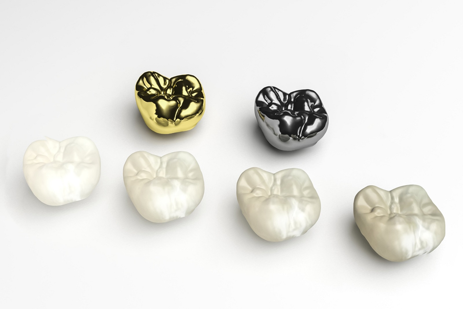 Dental Crowns: Types of Dental Crowns