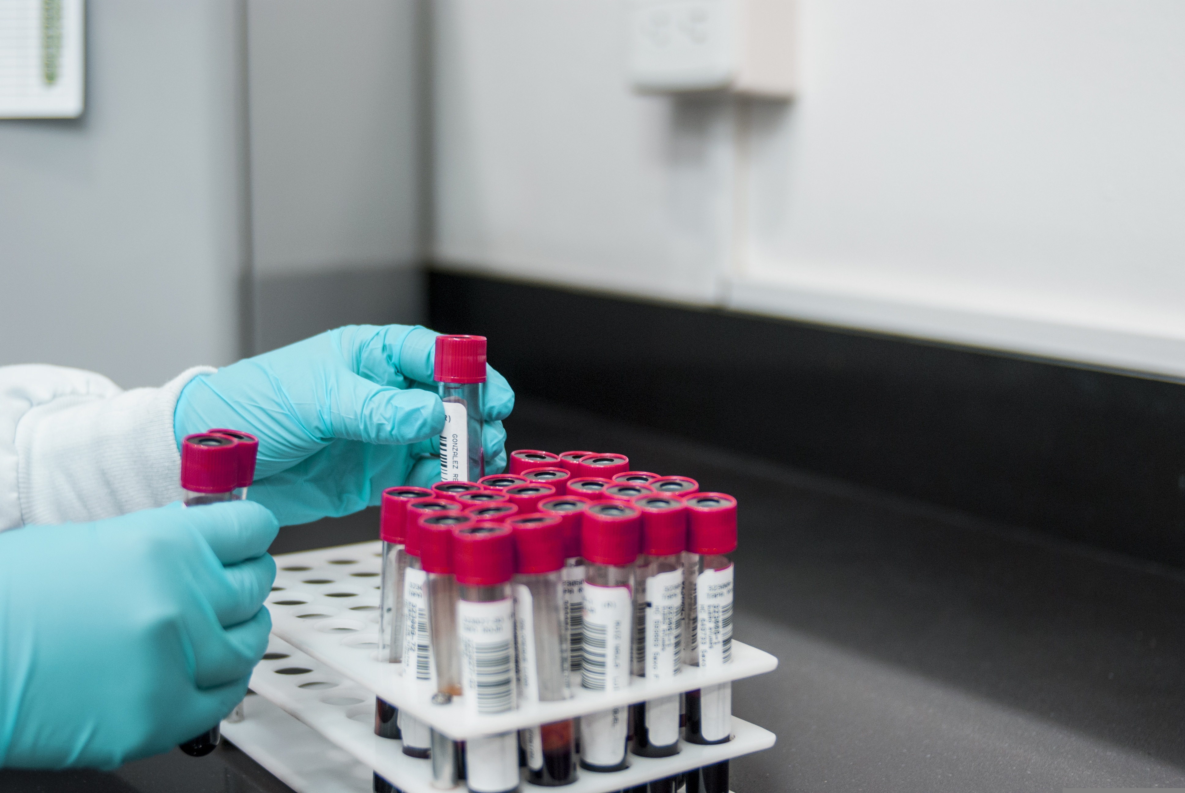 Blood Collection Market Business Strategies and Massive Demand by 2032