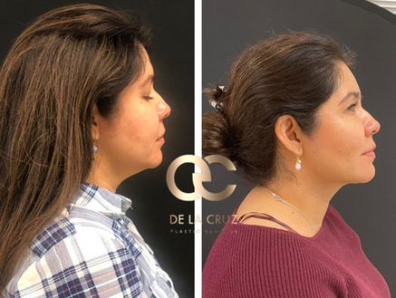 The Best BBL Plastic Surgeons In The World