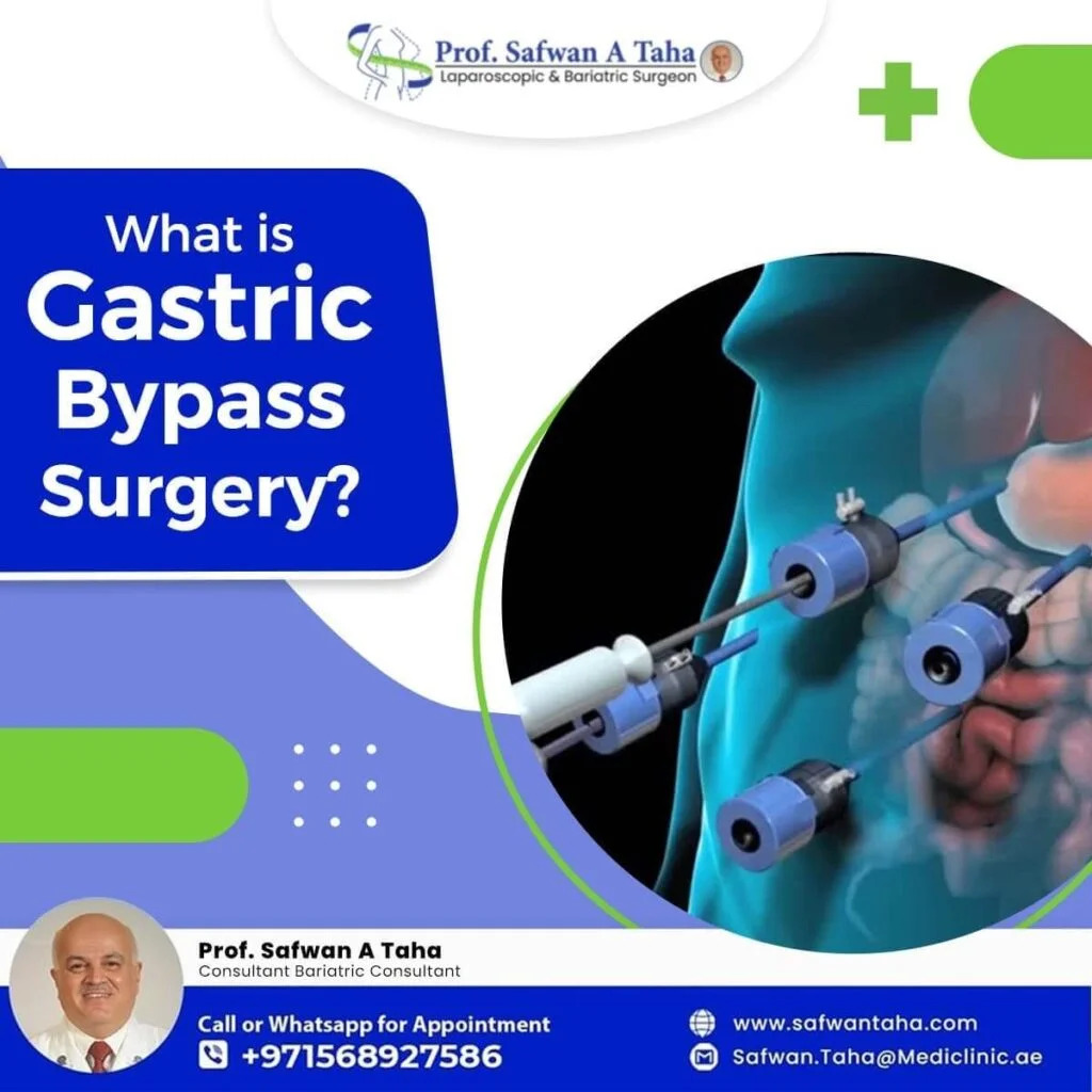 Top 5 Benefits of Gastric Balloons