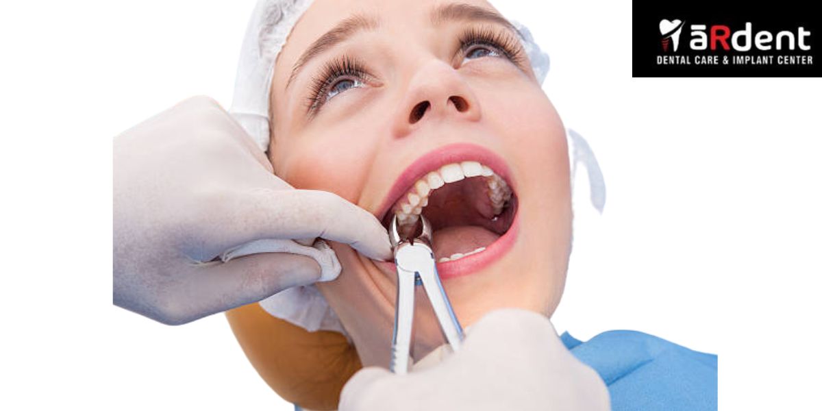 How To Take Care Of Yourself After Getting Your Wisdom Teeth Pulled