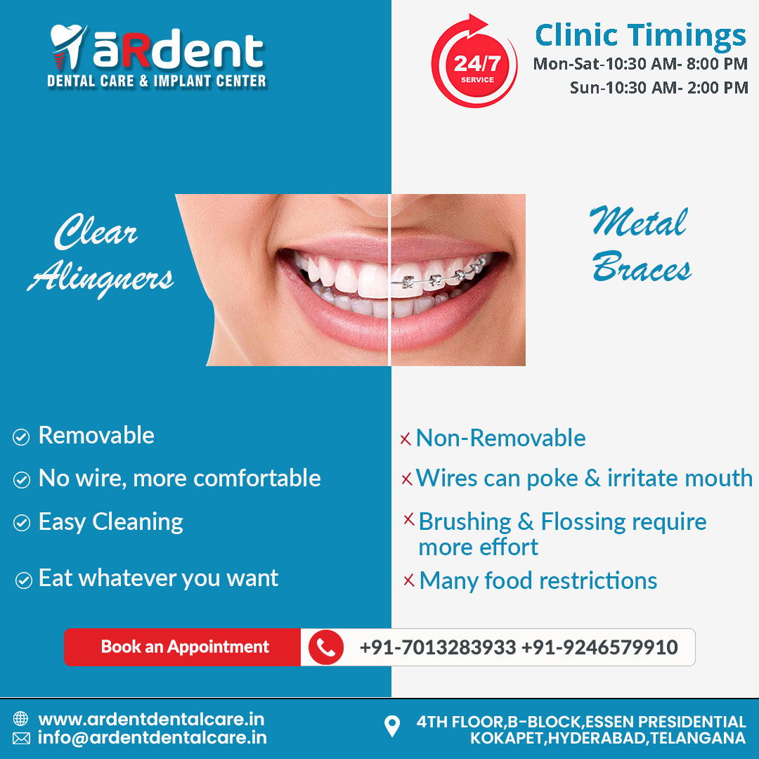 Transform Your Smile with Expert Teeth Braces Treatment in Kokapet​
