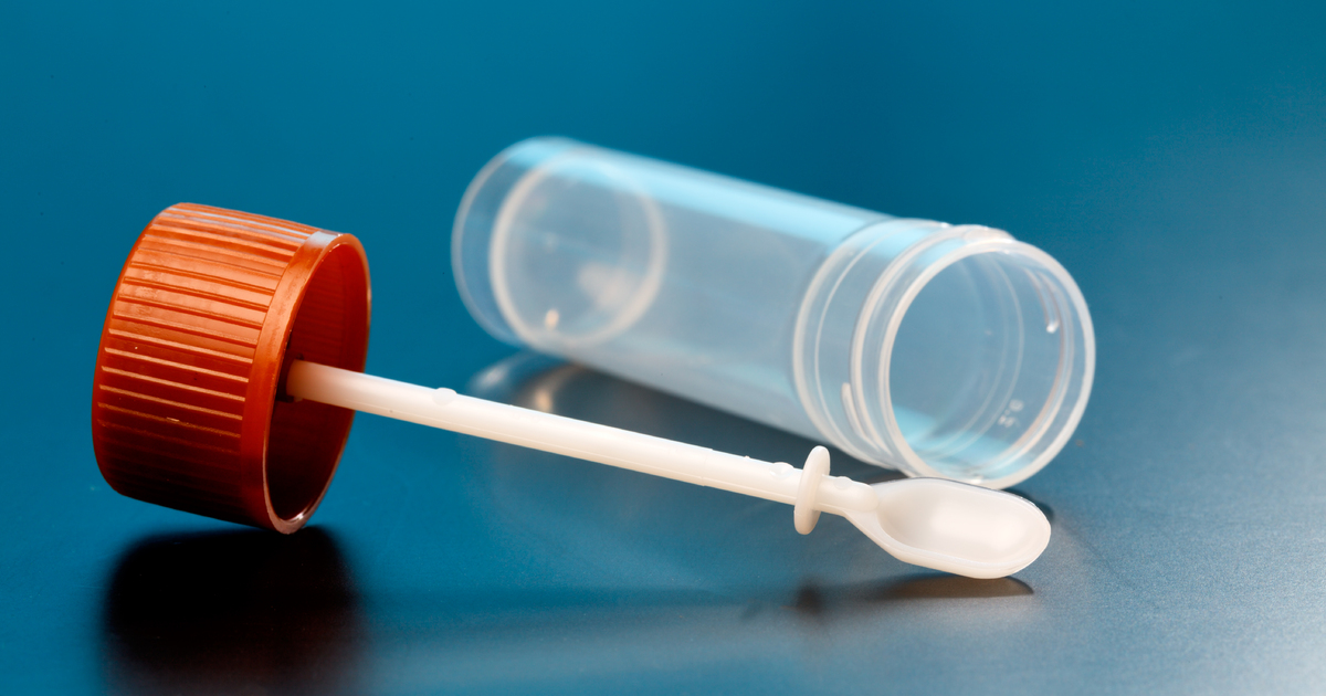 Global Faecal Calprotectin Testing Market 2022: COVID-19 Impact Analysis and Industry Forecast Report, 2028