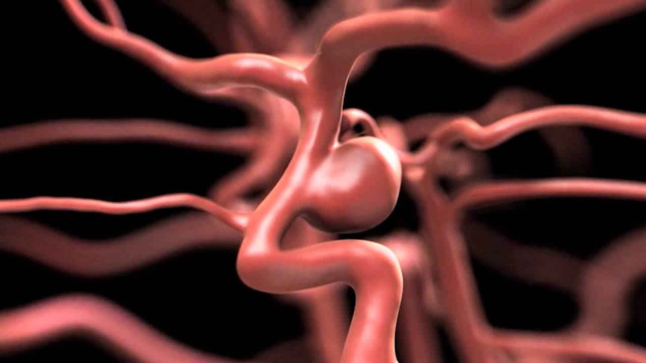 Flow Diversion Aneurysm Market Size, Share, Growth Opportunity & Global Forecast to 2028