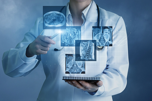 Global Digital X-ray market is projected to worth USD 17.2 Billion by 2030
