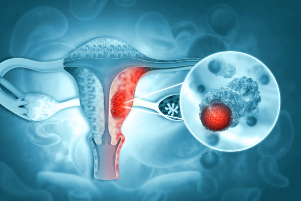 Global Gynecology Drugs Market is projected to be worth USD 2788 million by 2030