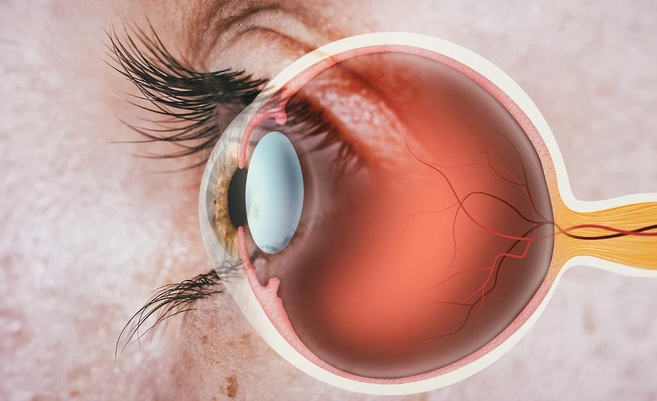 Retinal Disorders Treatment Market Latest Technological Developments Report 