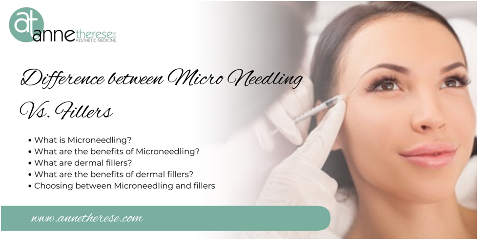 Difference between Micro Needling Vs. Fillers 