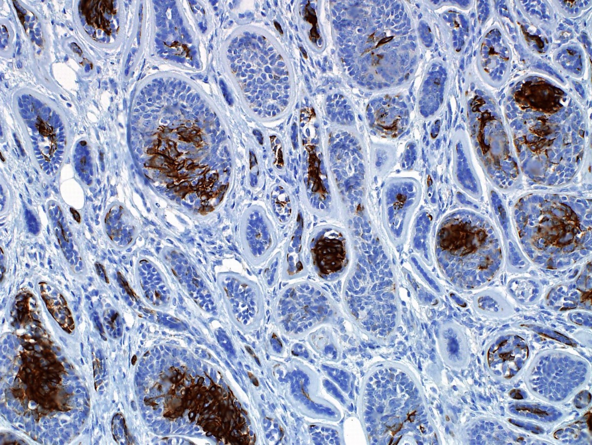 Immunohistochemistry Market Size, Share, Demand, Growth & Trends by 2032