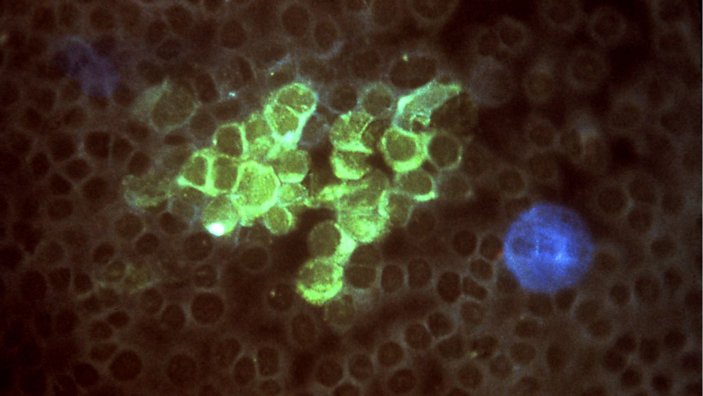 Monoclonal Antibodies (MAbS) Market Key Trends And Strategies For Expansion 2023-2032