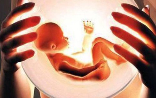 Contraceptive Options: Pros and Cons