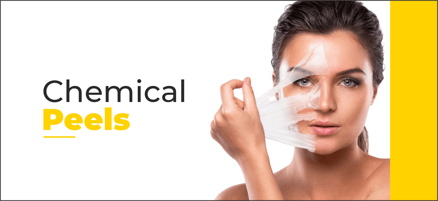 How does chemical peeling treatment work?