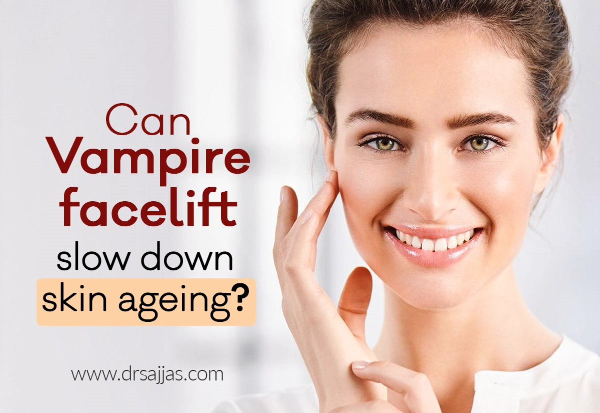 Can vampire facelift slow down skin ageing?