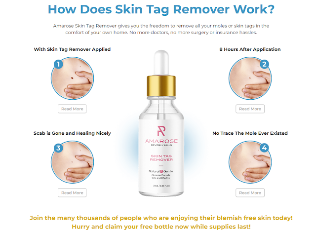 What is Amarose Skin Tag Remover?