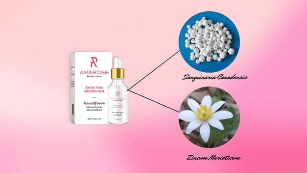 Feature Amarose's Outcome Situated Fixings!