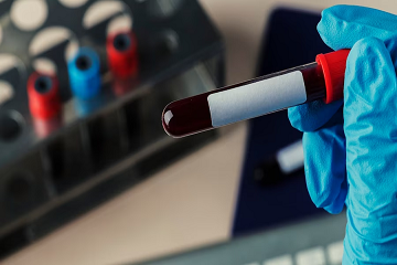 Libya Blood Gas Analyzer Market Analysis — Ken Research