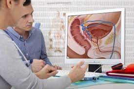 United States Prostate Cancer Testing Market: Opportunities, Size and Growth Projections in Upcoming Years
