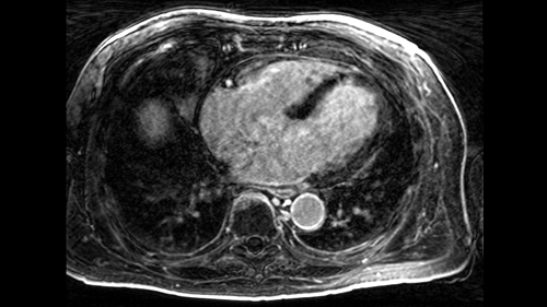 India Cardiac Medical Imaging Software Market to Establish Growth with Higher Investments Until FY2027
