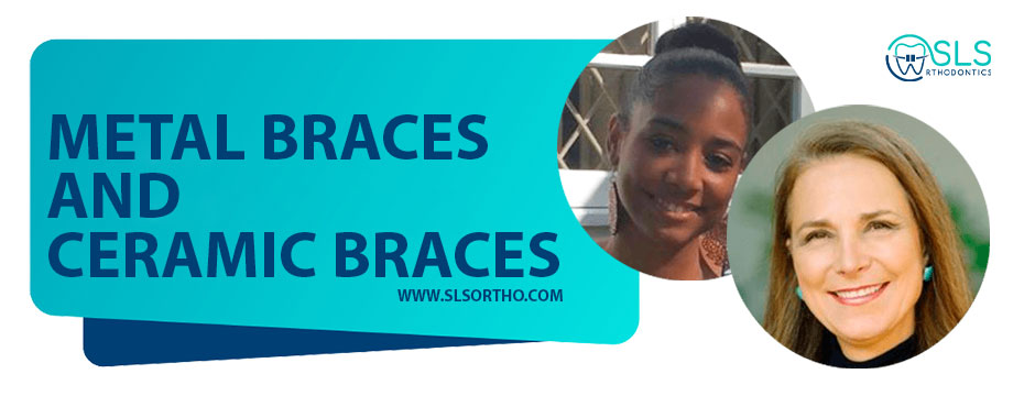Learn more about metal braces and ceramic braces