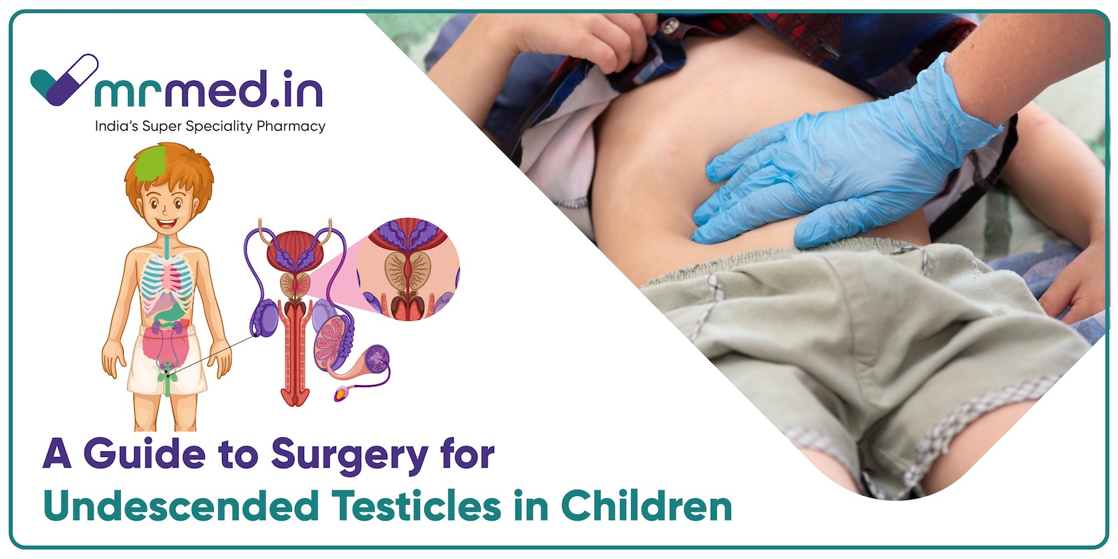 Surgery for Undescended Testicles: What Parents Need to Know