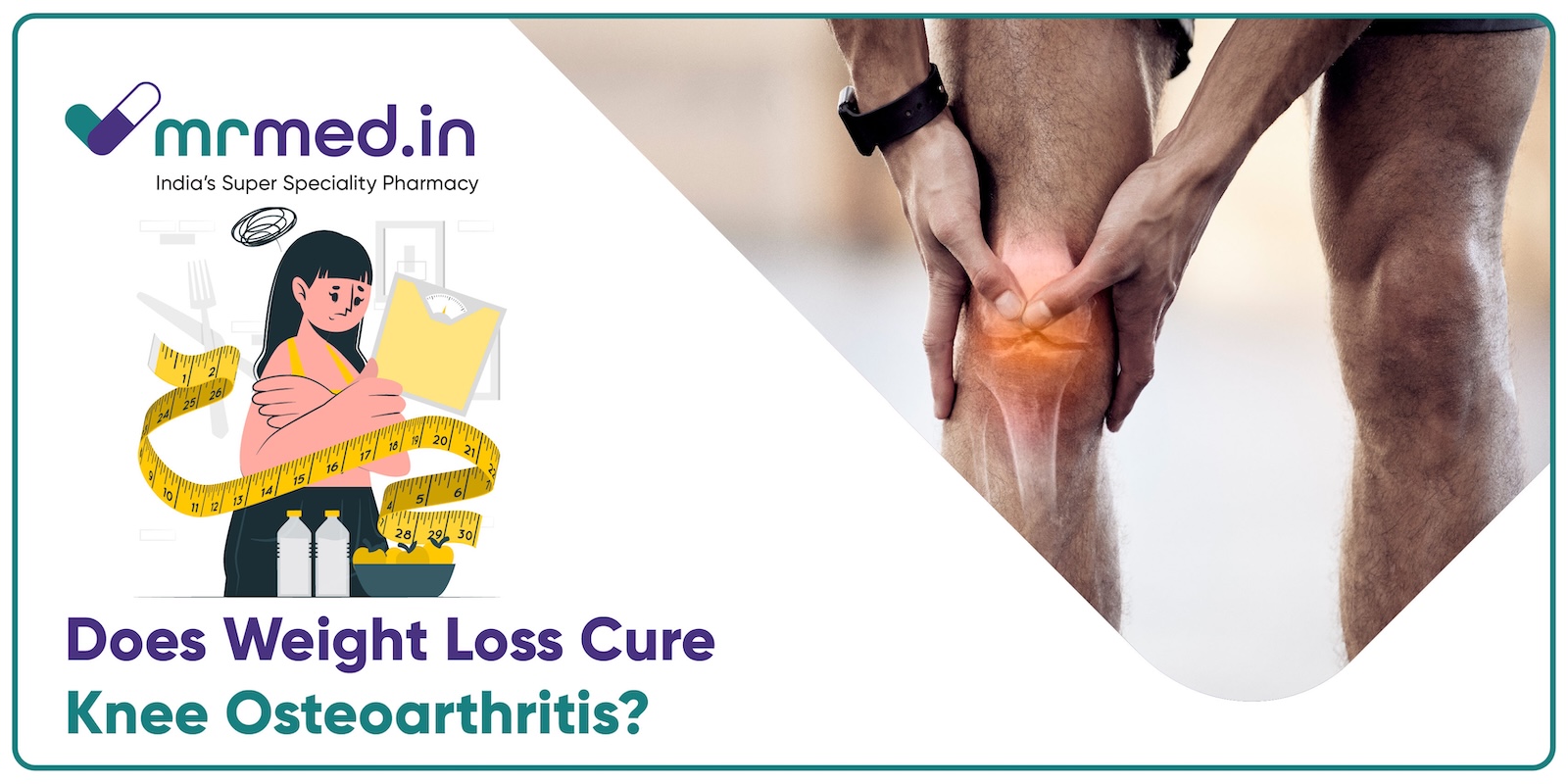 Can Weight Loss Help Manage Knee Osteoarthritis?