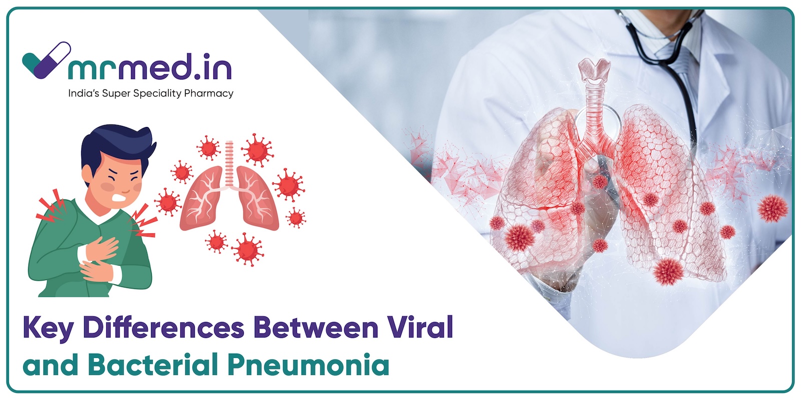 Viral vs. Bacterial Pneumonia: What’s the Real Difference?