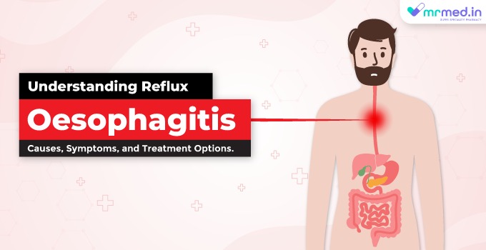 Understanding Reflux Oesophagitis: Causes, Symptoms, and Treatment Options