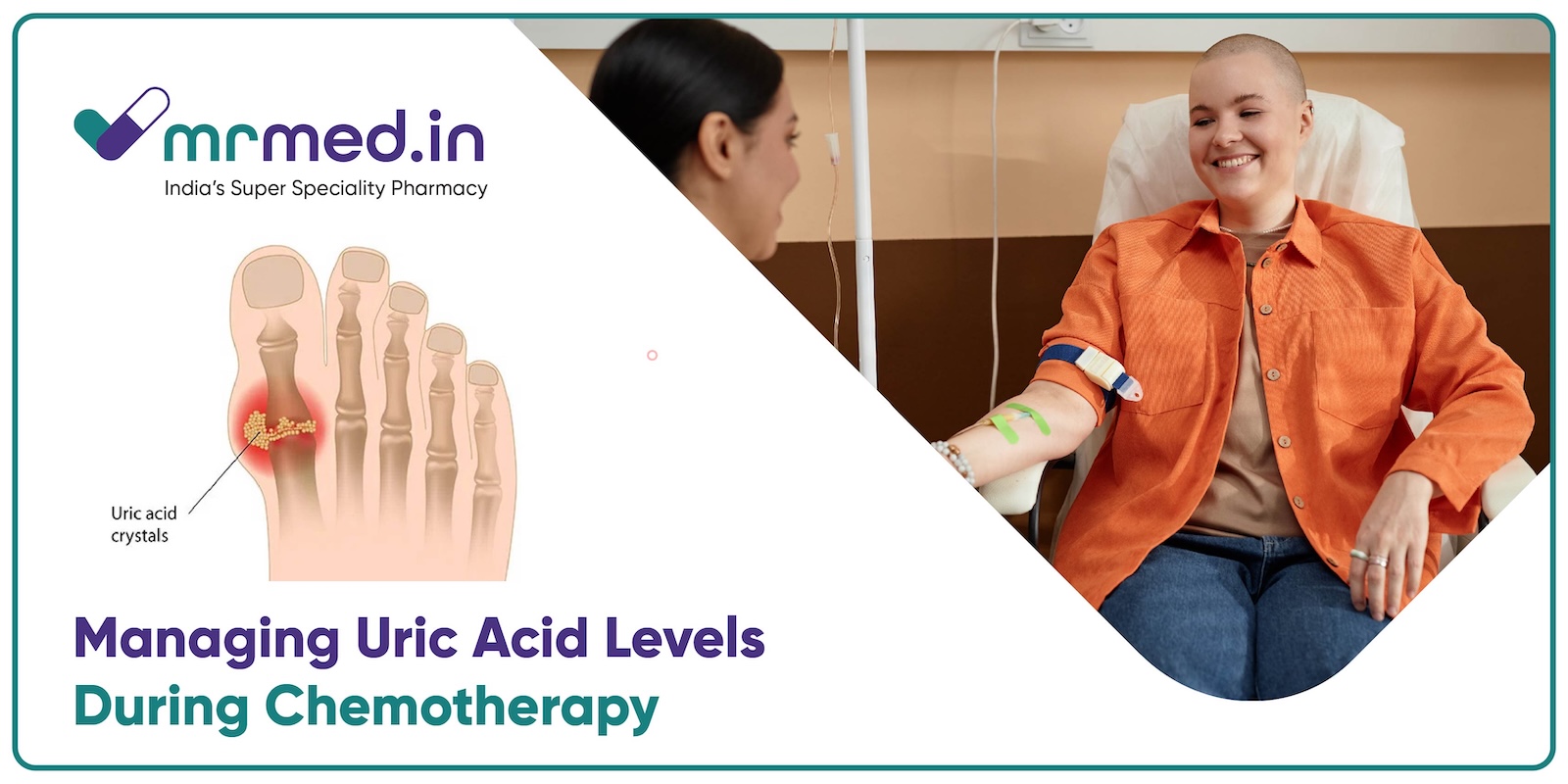 Why Uric Acid Levels Matter in Chemotherapy and How to Control Them