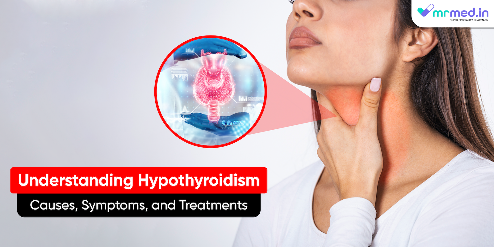 Understanding Hypothyroidism: Causes, Symptoms, and Treatments