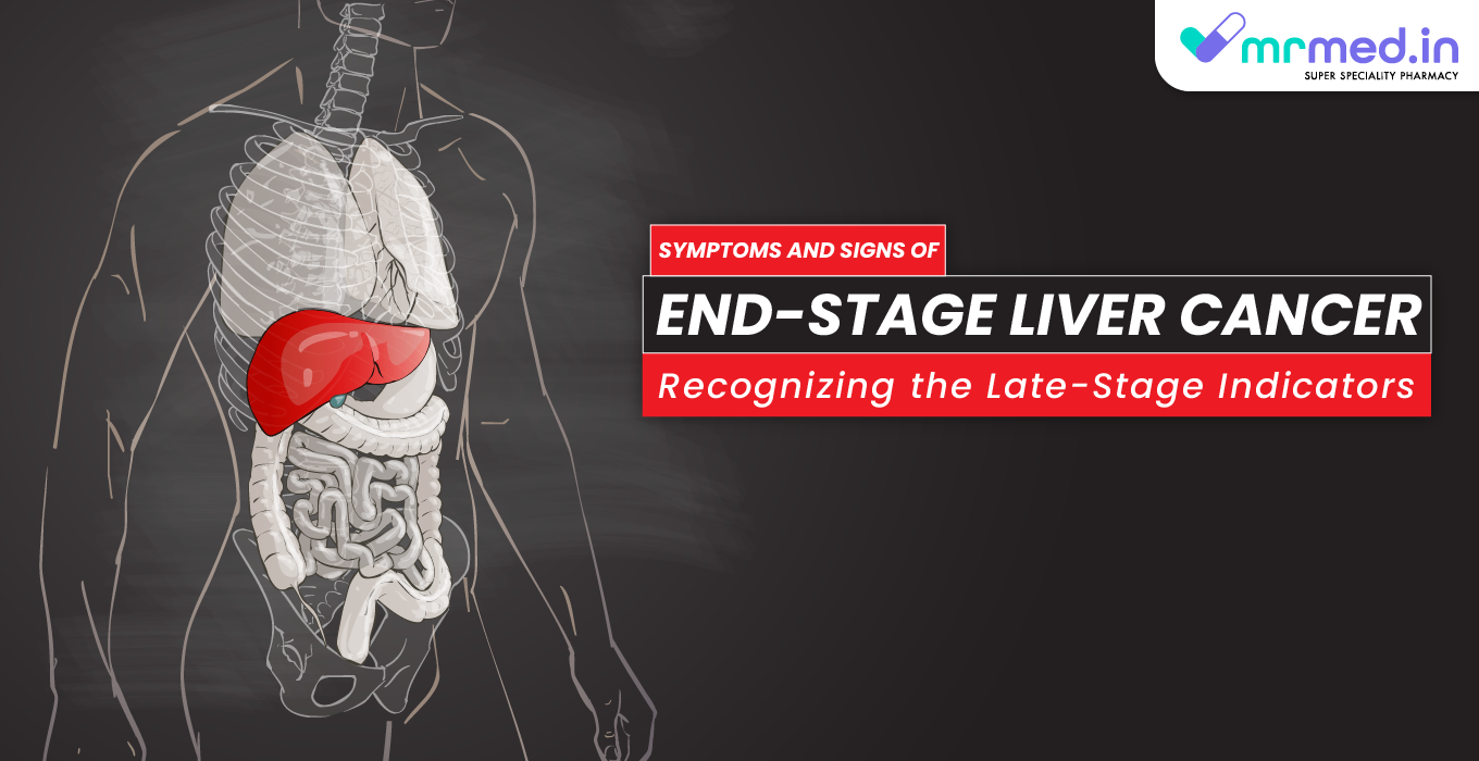 Symptoms and Signs of End-Stage Liver Cancer: Recognizing the Late-Stage Indicators