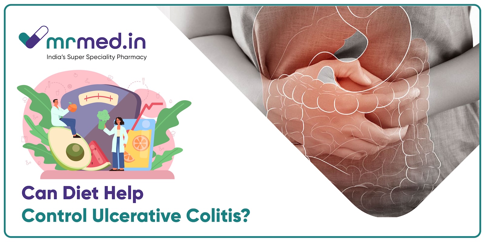 The Role of Anti-Inflammatory Diets in Controlling Ulcerative Colitis