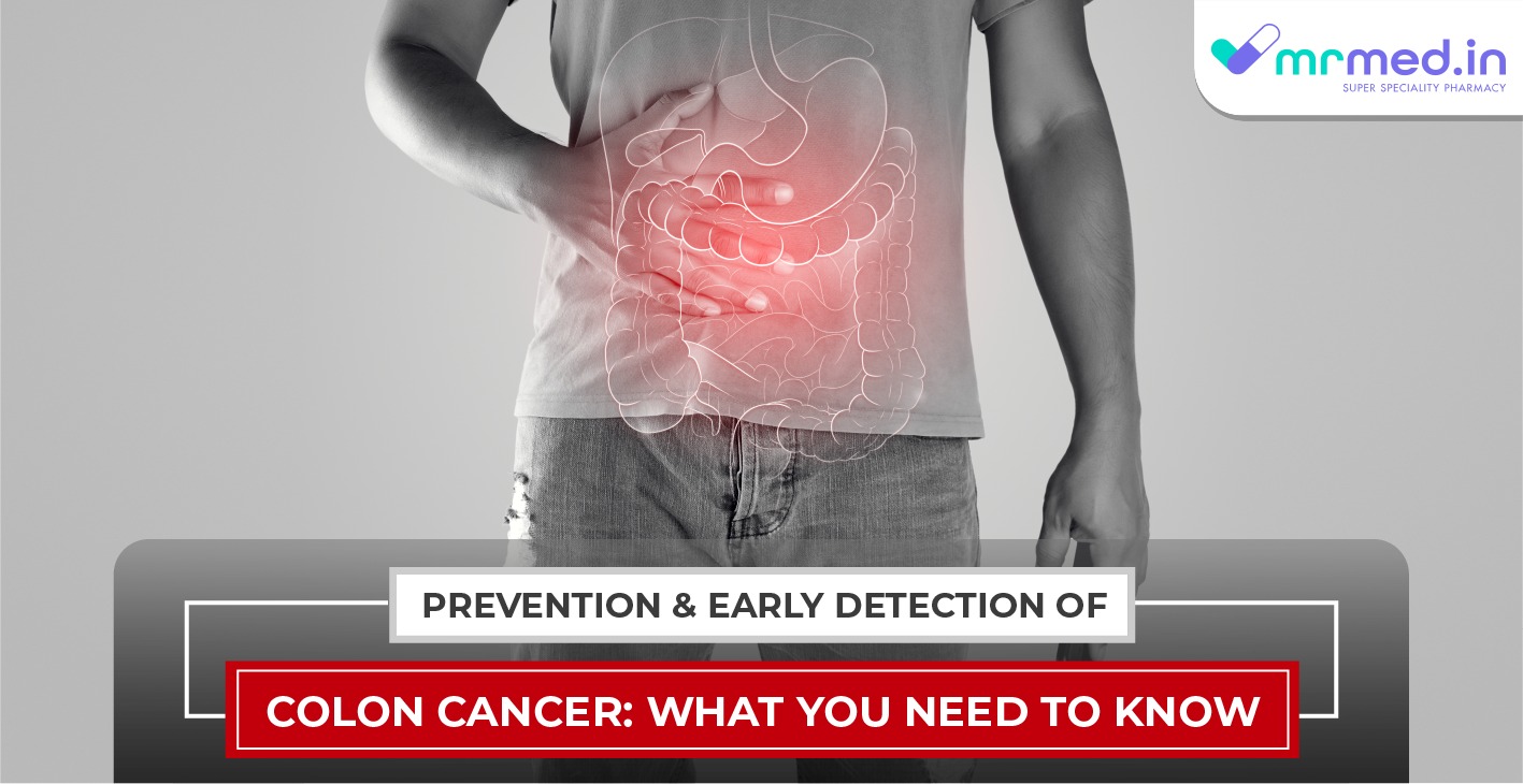 Prevention and Early Detection of Colon Cancer: What you Need to Know