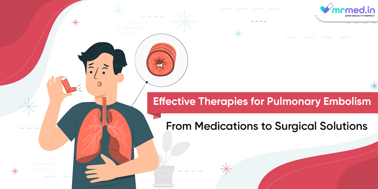 Effective Therapies for Pulmonary Embolism: From Medications to Surgical Solutions