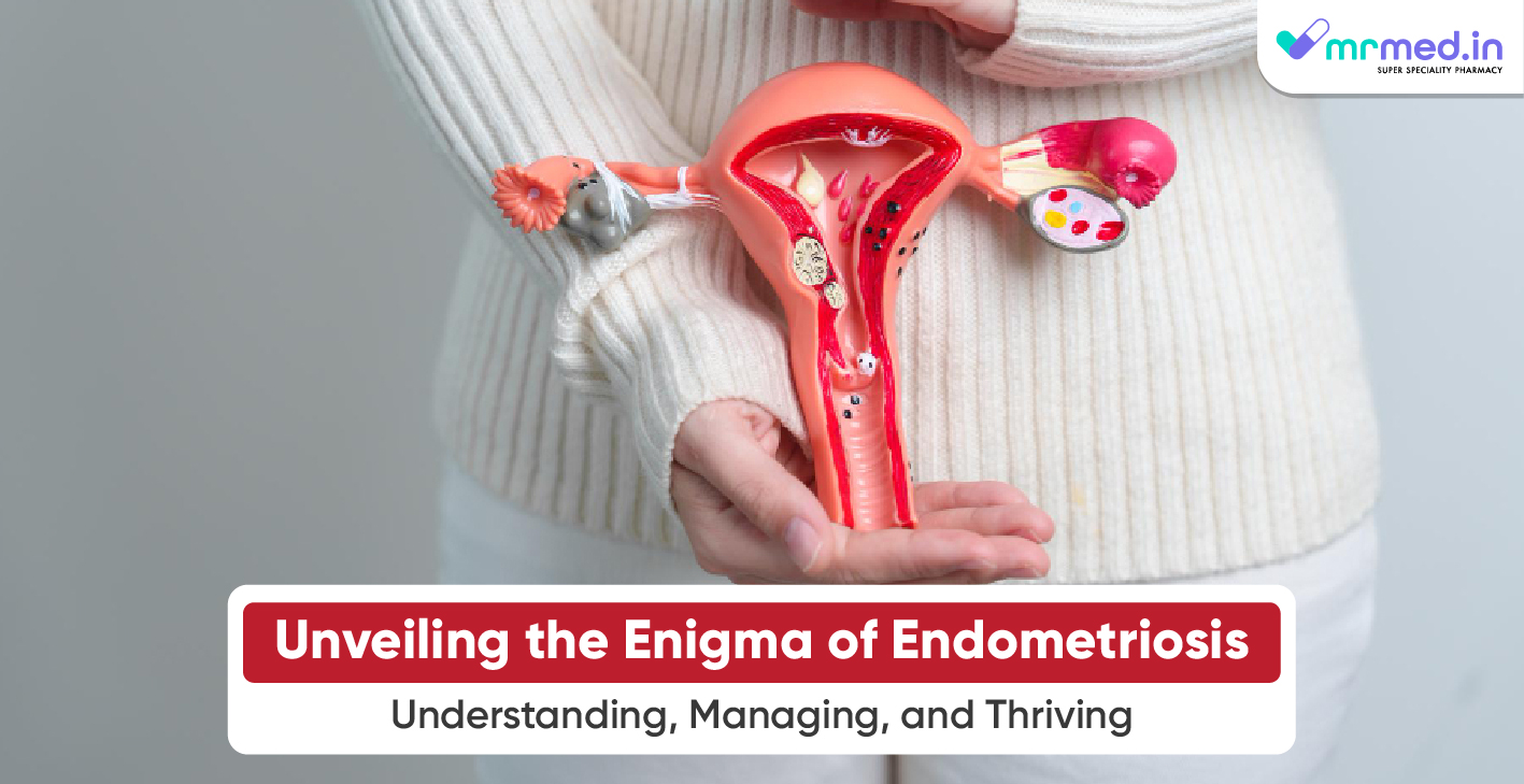 Unveiling the Enigma of Endometriosis: Understanding, Managing, and Thriving