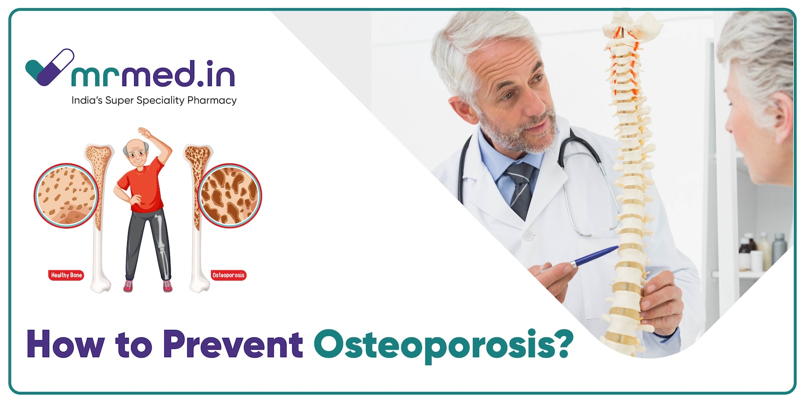 How to Maintain Bone Density and Prevent Osteoporosis
