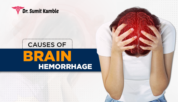 What are the causes of Brain Haemorrhage?