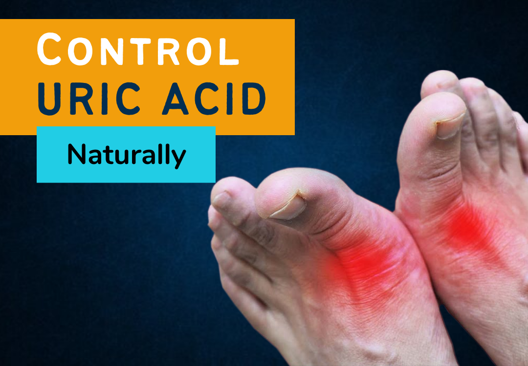 How To Control Uric Acid Naturally?  