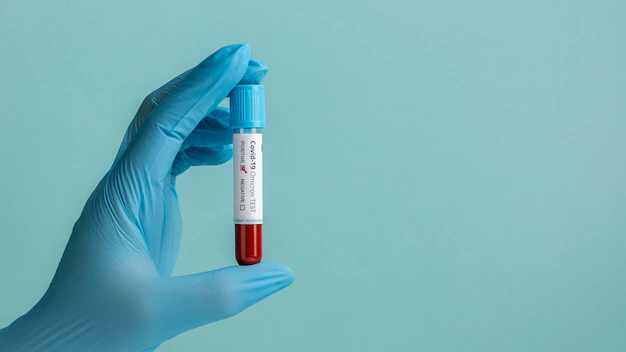 CBC test: What does it say about your health?