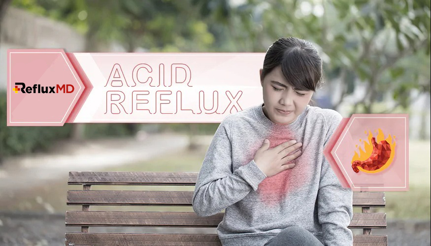 5 Foods to Avoid that Cause Acid Reflux