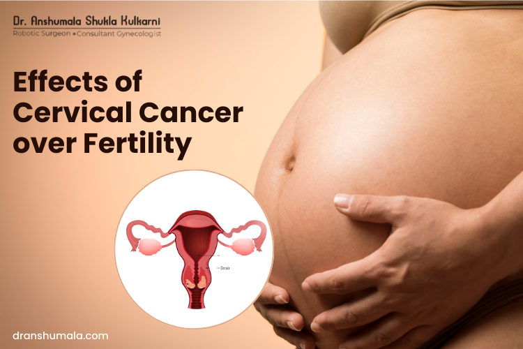 Effects of Cervical Cancer over Fertility