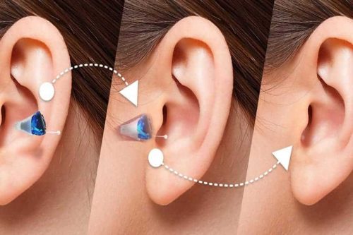 Benefit of Rechargeable Hearing Aids