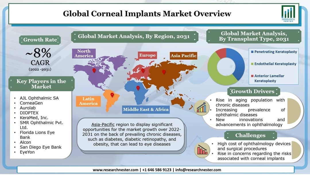 Corneal Implants Market Size, Share, Analysis, Growth & Industry Report, 2031