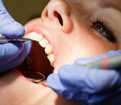 dental root canal treatment in udaipur