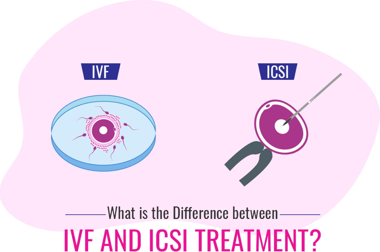 IVF And ICSI Exрlаined