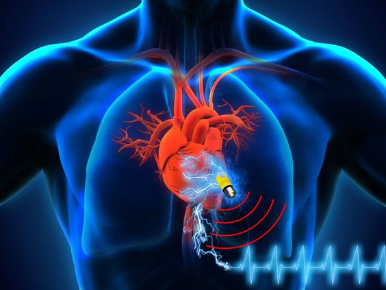 Vagus Nerve Stimulation Market Competitive Landscape, Growth Factors, Revenue Analysis To 2029