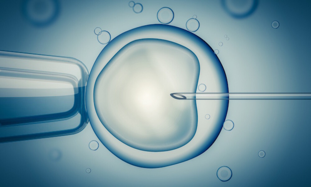 Rising Infertility Among Men and Women to Facilitate the Growth of In Vitro Fertilization Market with a CAGR of 10.3% During 2019-2027