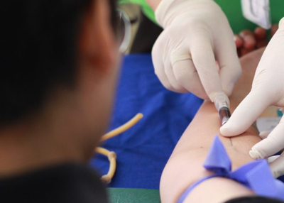 PRP : Platelet Rich Plasma Treatment