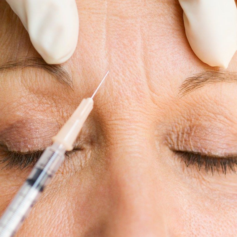 BENEFITS OF GETTING ANTI-WRINKLE INJECTIONS
