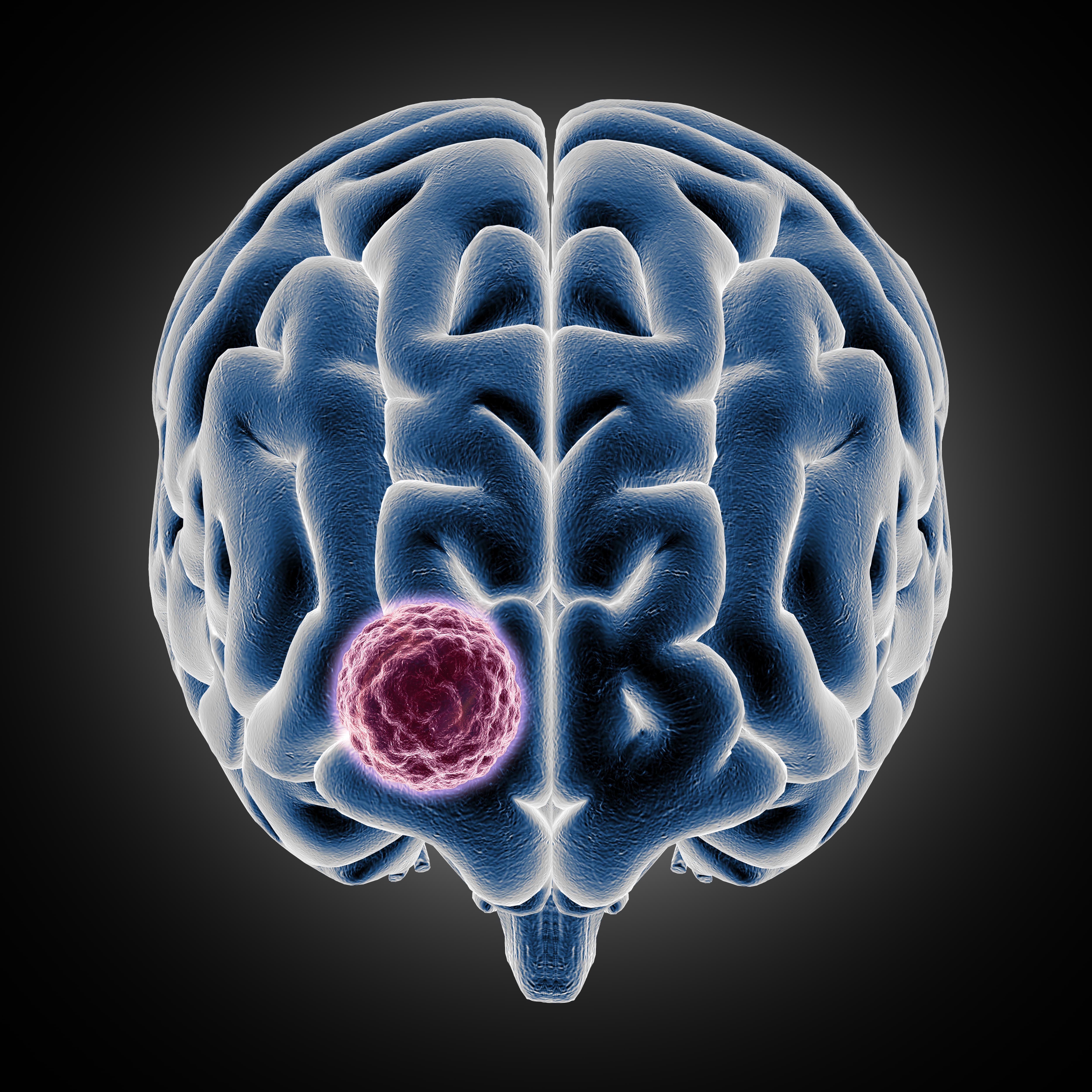 Tumor Embolization Devices Market Analysis, Segmentation, Outlook And Trends Report 2032